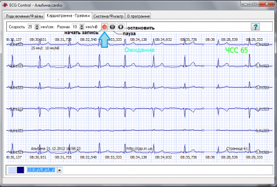 Screenshot of the application ECG Control - #2