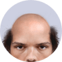 Download Bald Face