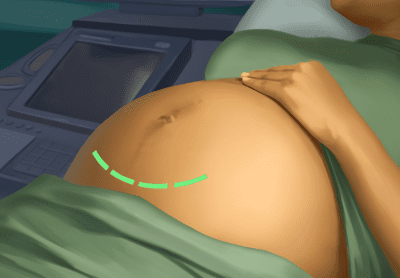 Screenshot of the application Operate Now: Hospital - #2